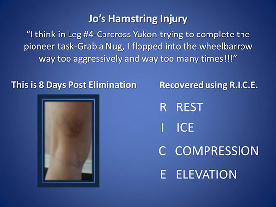 Jos-Hamstring-Injury